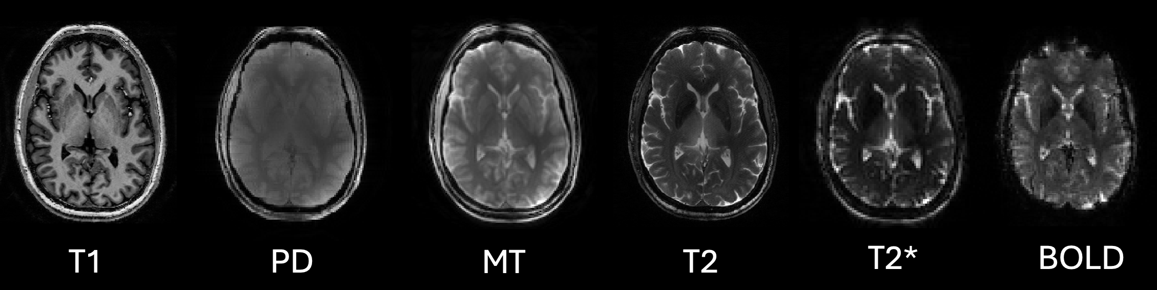 Image of 7T anatomic brain mapping